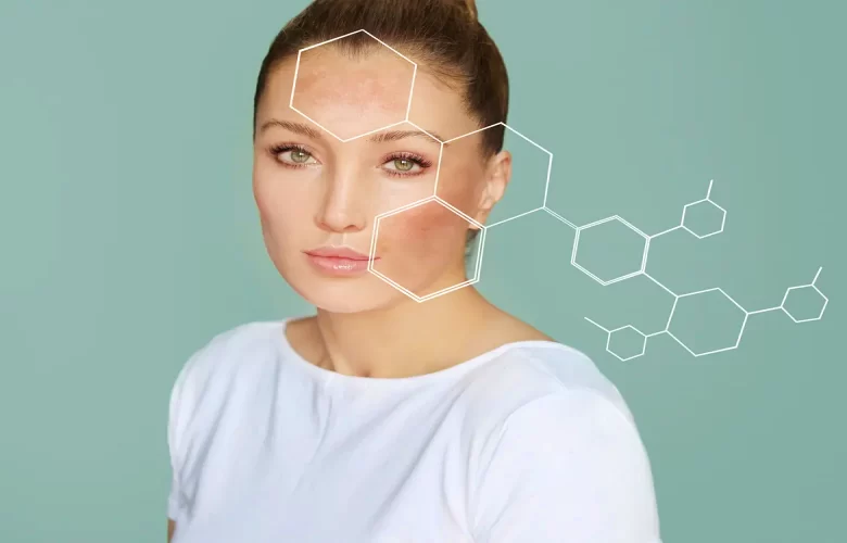 أسباب الاصابة بالبقع العمرية على البشرة والتعامل الأمثل معها