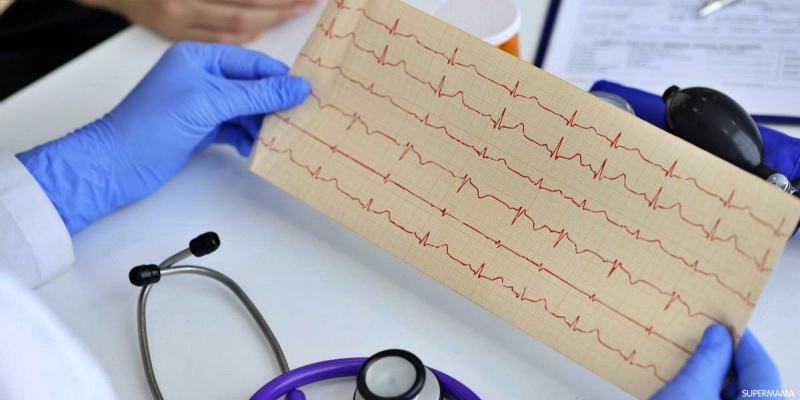 قياس مخطط كهربية القلب (ECG)