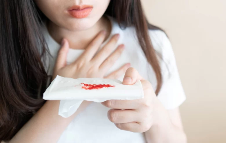 السعال الدموي