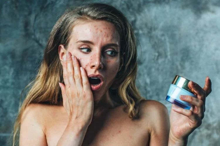 حساسية مستحضرات التجميل