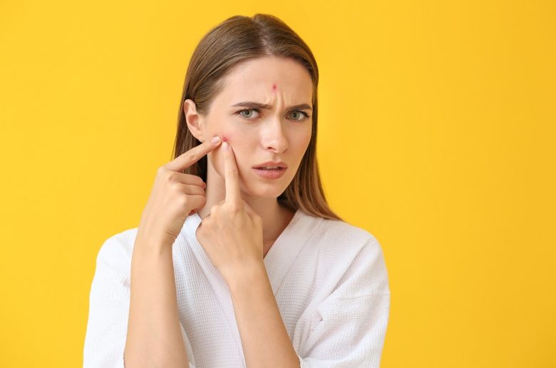 متلازمة فقع البثور