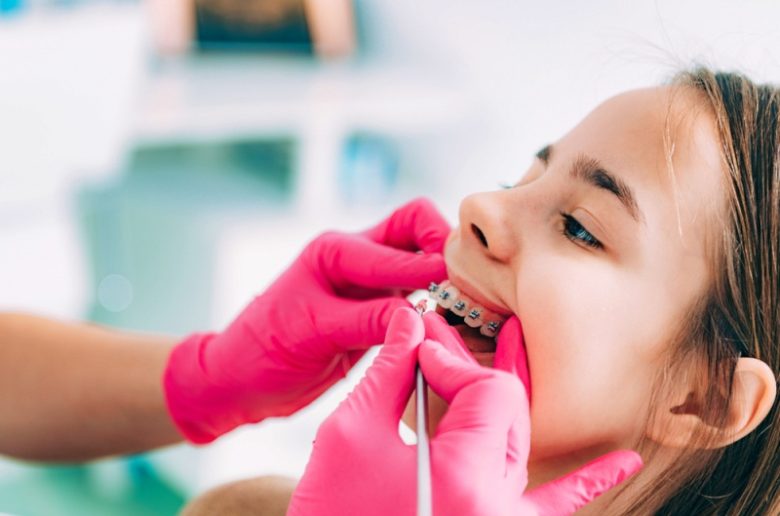 ما هو العمر الأنسب للقيام بإجراء تقويم الأسنان؟ ما هو العمر الأنسب للقيام بإجراء تقويم الأسنان؟