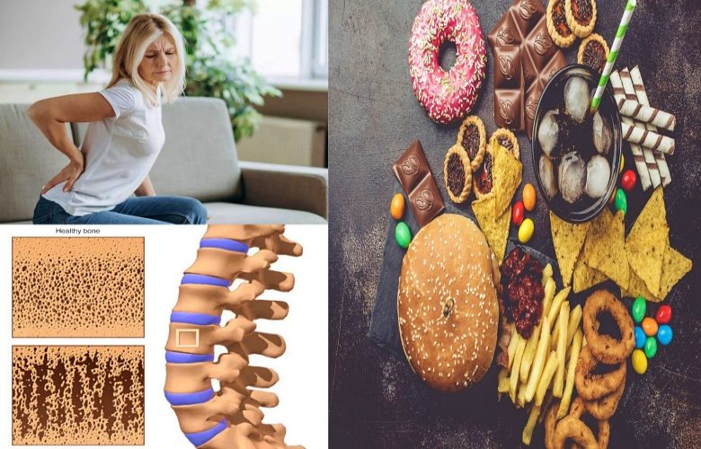 5 أطعمة من الواجب تجنبها عند الإصابة بهشاشة العظام 5 أطعمة من الواجب تجنبها عند الإصابة بهشاشة العظام