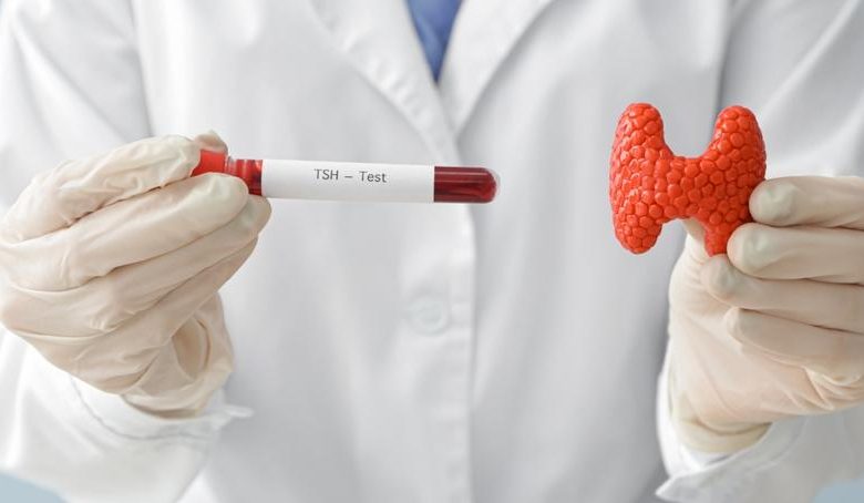 اختبار هرمون الغدة الدرقية