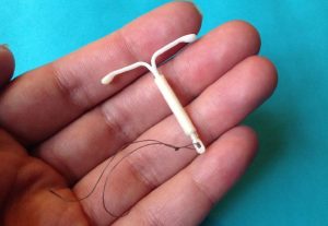 تركيب جهاز منع الحمل (IUD)