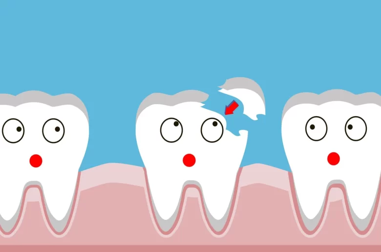 طرق فعالة لتقليل ألم السن المكسور