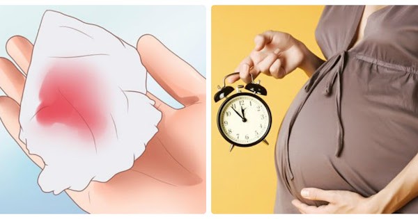 هل نزيف الحمل المفرط دلالة على قرب ولادة طفلك ؟