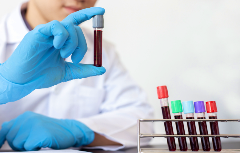 5 اختبارات دم أساسية يجب العمل على إجراؤها سنويا