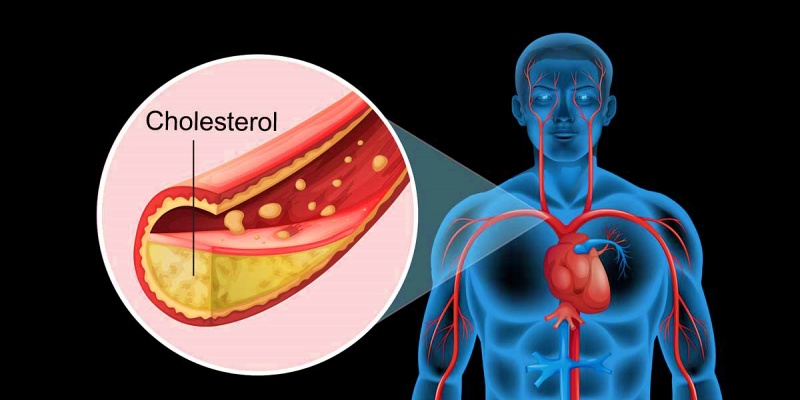 ما المقصود بالكوليسترول في الدم؟