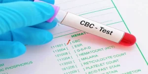 &nbsp;اختبار صورة الدم الكاملة (CBC)