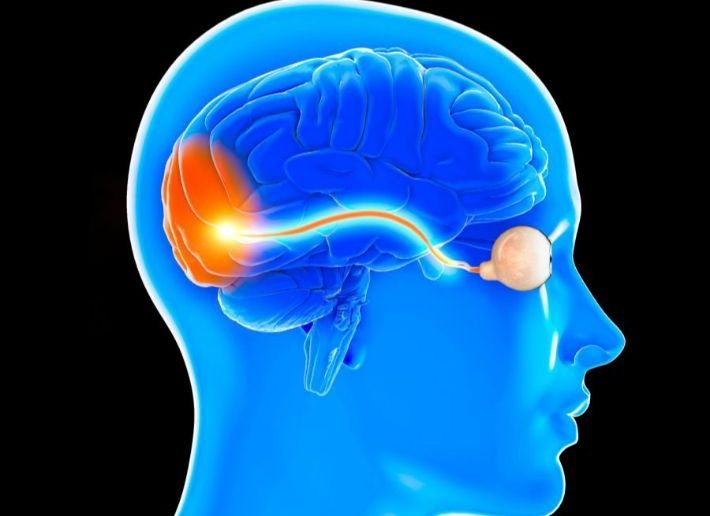 التهاب العصب البصري