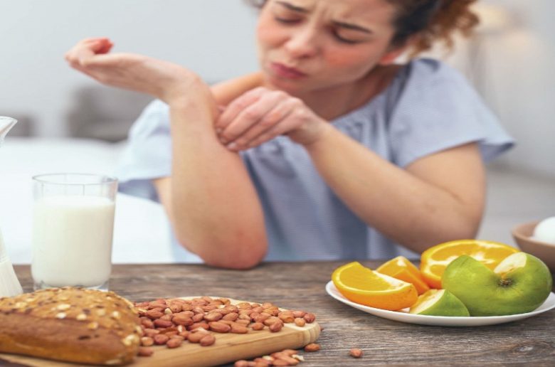 5 أطعمة تسبب الحساسية لمصابين التهاب الجلد التأتبي 5 أطعمة تسبب الحساسية لمصابين التهاب الجلد التأتبي