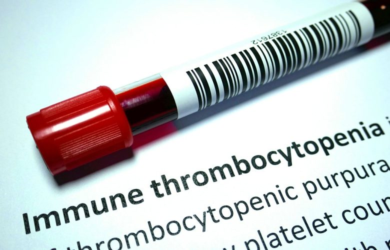  5 أسئلة شائعة وهامة حول نقص الصفيحات المناعي