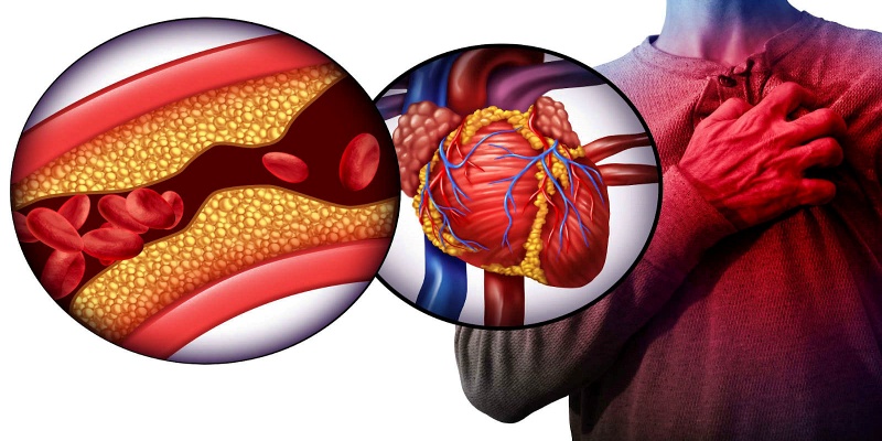 مضاعفات القلب والأوعية الدموية