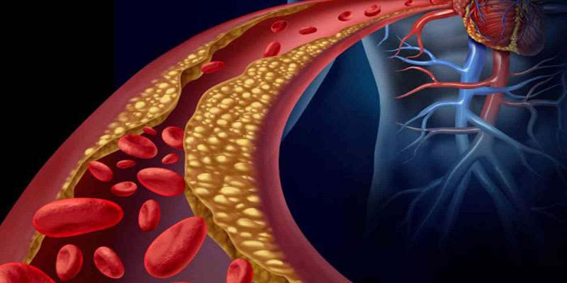 ما مدى تأثير نسبة الكوليسترول في الجسم على صحة الفرد؟