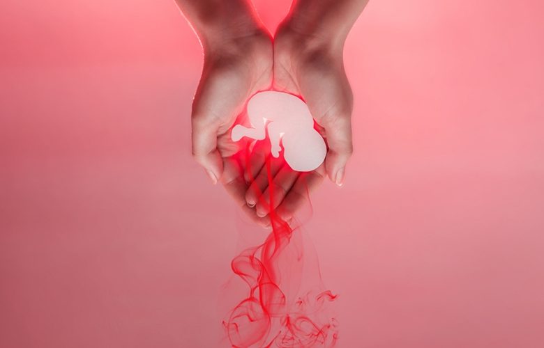 الإجهاض المتكرر