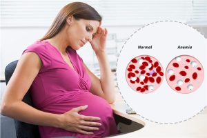 فقر الدم أثناء الحمل