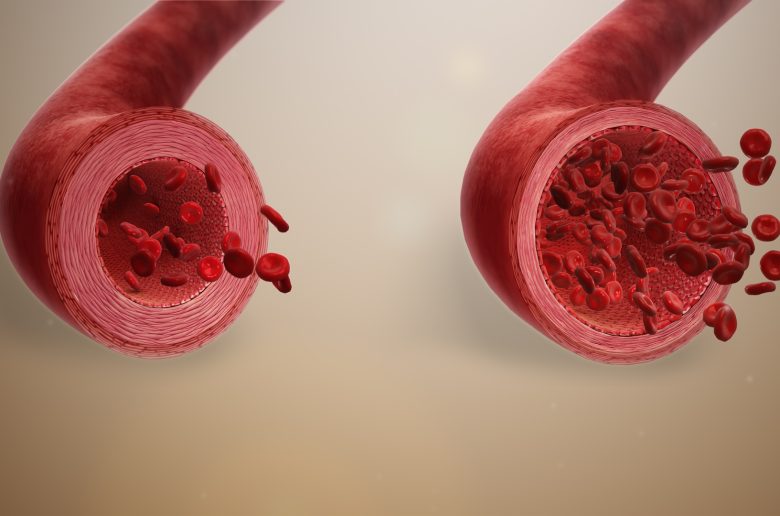 ماهي قابضات الأوعية الدموية ؟