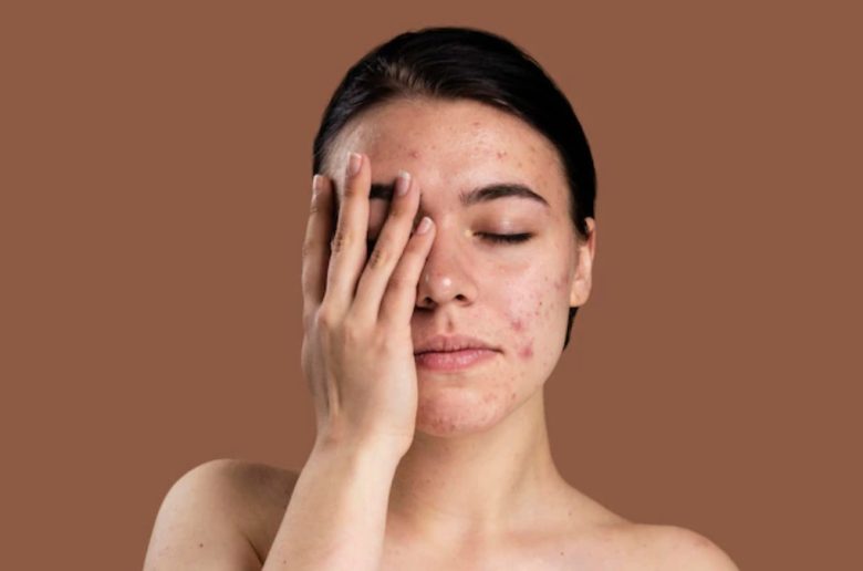 مواد يجب الحذر عند تطبيقها على بشرة وجهك