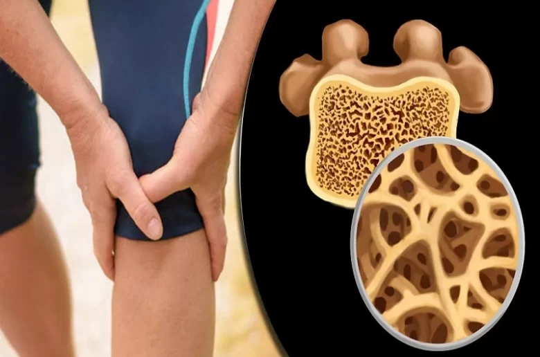 هشاشة العظام في الركبة وكيف نستطيع التعامل مع هذا الأمر؟ هشاشة العظام في الركبة وكيف نستطيع التعامل مع هذا الأمر؟