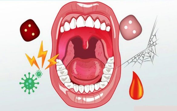 3 أمراض شائعة ومزعجة تصيب تجويف الفم 3 أمراض شائعة ومزعجة تصيب تجويف الفم