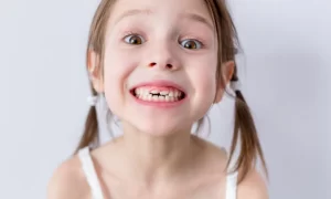 الأسنان الملتوية لدى الأطفال