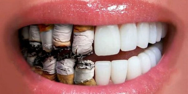 تجنب ممارسة العادات الضارة بصحة الأسنان