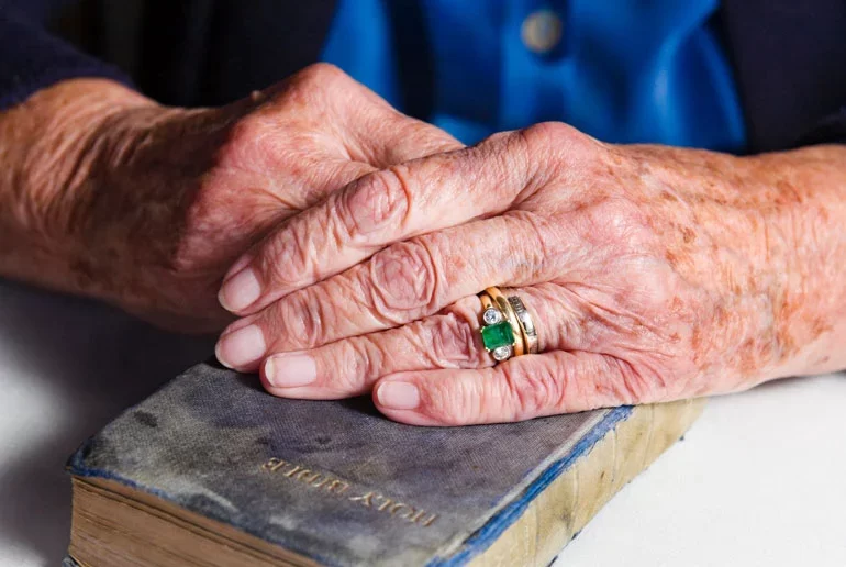 ظاهرة البقع البنية الداكنة على جلد اليدين