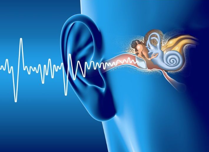 ورم العصب السمعي