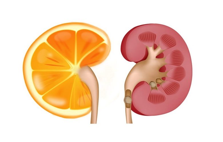 ما مدى آمان تناول فيتامين C على صحة الكلى؟