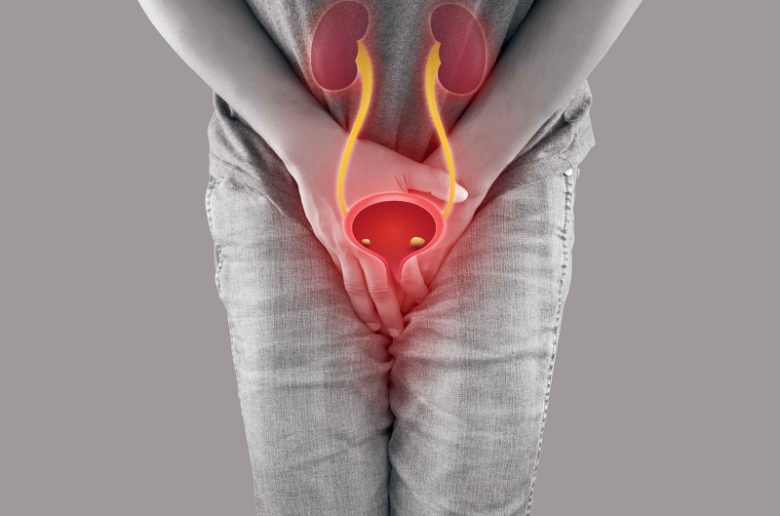 حصوات المثانة وكيف نستطيع وقاية أنفسنا منها؟ حصوات المثانة وكيف نستطيع وقاية أنفسنا منها؟