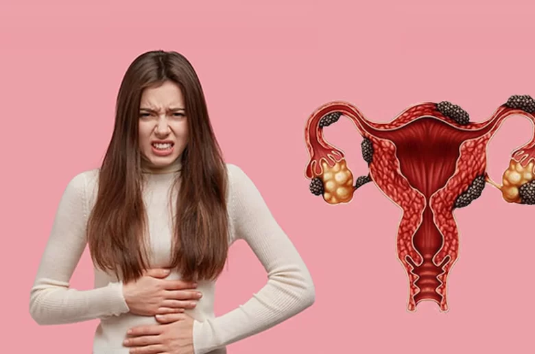 أكياس الشيكولاتة أكياس الشيكولاتة