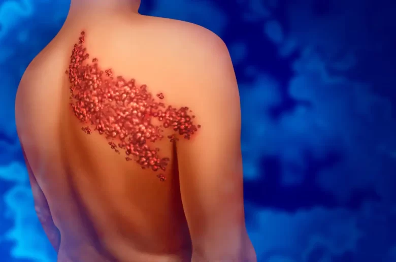 الحزام الناري