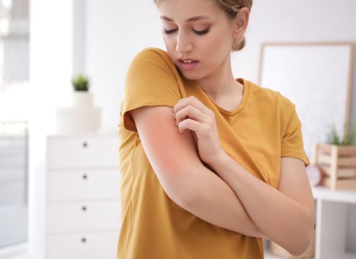 العلاجات المنزلية لحكة الجلد في فصل الصيف العلاجات المنزلية لحكة الجلد في فصل الصيف