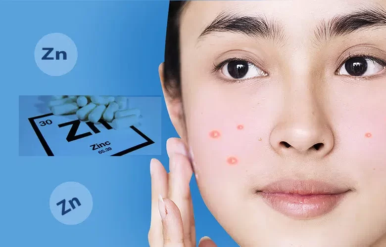 مكملات الزنك لعلاج حب الشباب مكملات الزنك لعلاج حب الشباب