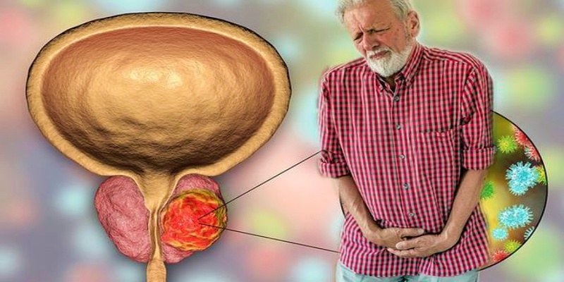 أهم العلامات المبكرة التي تدل على إصابة البروستاتا بالأورام الليفية