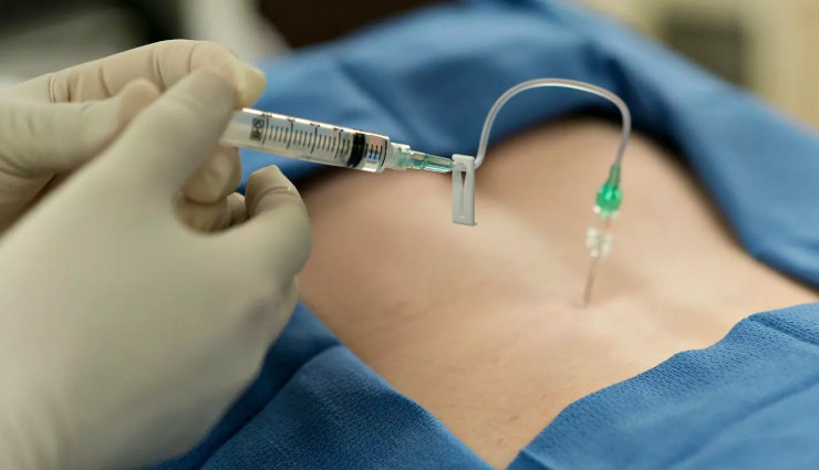 التخدير النصفي في الولادة القيصرية التخدير النصفي في الولادة القيصرية