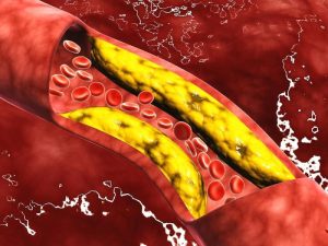 مخاطر تناول مرضى  القلب والكوليسترول للحم الضاني