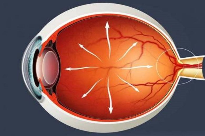 أدوية ترفع ضغط العين