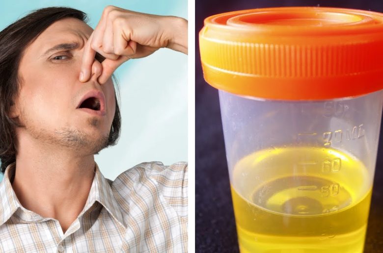 أسباب الرائحة الغريبة للبول أسباب الرائحة الغريبة للبول