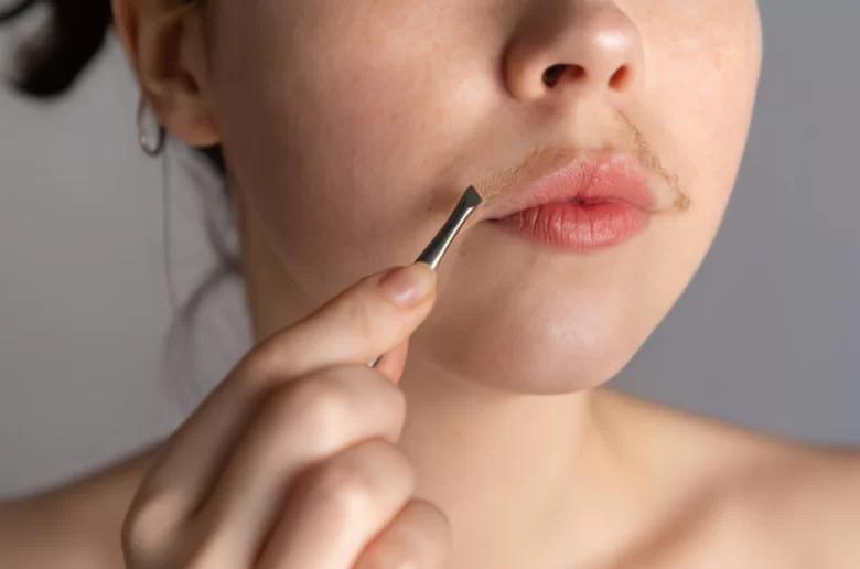 مشكلة كثافة شعر الوجه الناجم عن تكيسات المبايض