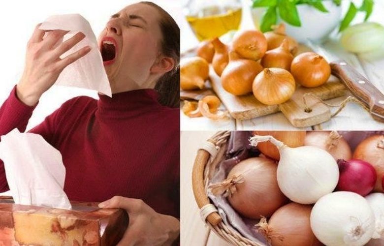 حساسية البصل.. ماهي؟ وأهم الأعراض وطرق العلاج