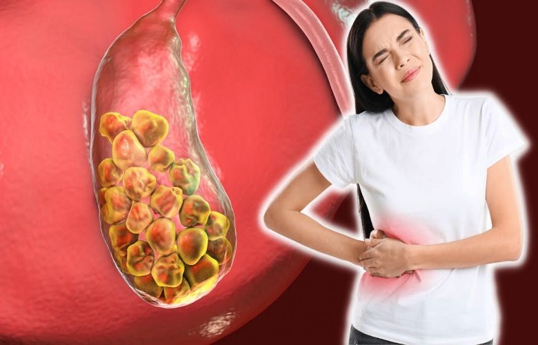 مضاعفات خطيرة تنتج عن تواجد الحصوات داخل المرارة