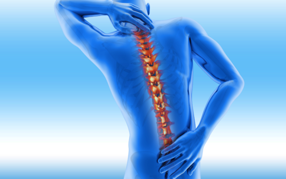 تكلس العمود الفقري.. الأسباب والأعراض وطرق العلاج
