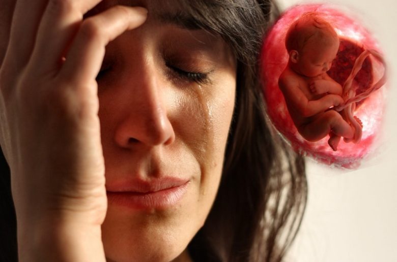 أنواع الإجهاض