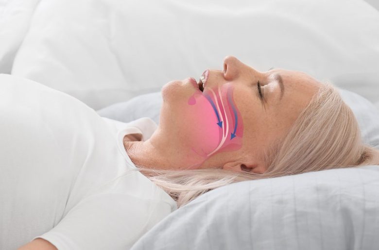 تأثيرات سلبية يسببها التنفس عن طريق الفم