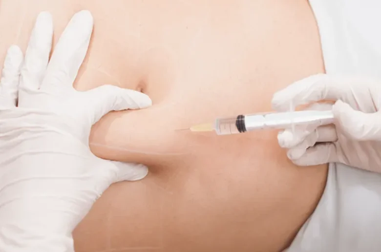 حقن الميزوثيرابي لإنقاص الوزن