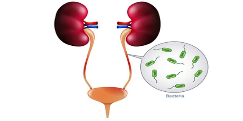 أسباب إصابة الرجال بالتهابات المسالك البولية