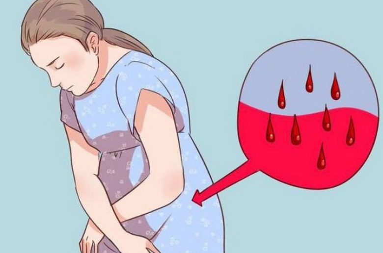 افرازات بعد النفاس