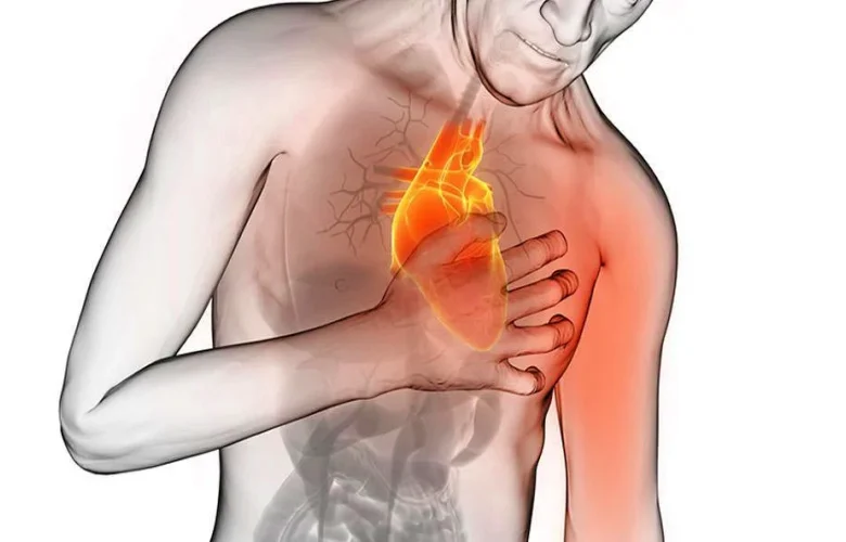 عوامل هامة تؤدي إلى حدوث الإصابة بالذبحة الصدرية